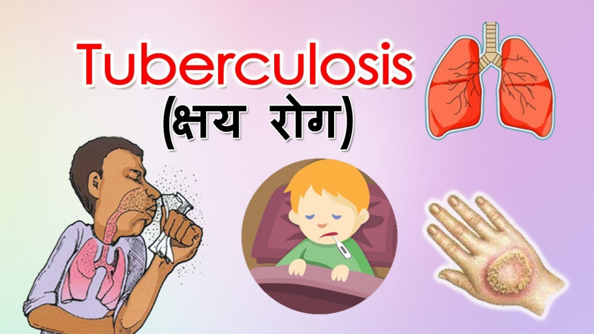 कहाँ हराए क्षयरोगका ४० हजार बिरामी ?